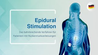 Epidural Stimulation Das bahnbrechende Verfahren für Patienten mit Rückenmarkverletzungen [upl. by Sib]