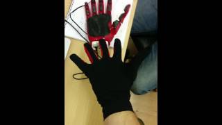 The Open Bionics hand controlled with sensor gloves [upl. by Ilana985]