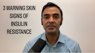 3 WARNING skin signs of INSULIN RESISTANCE precursor to DIABETES [upl. by Riatsila771]