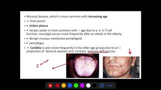 Dental lecture Prosthodontics Part 1 introduction [upl. by Pearse185]