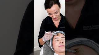 What is a Jessner Peel chemicalpeel skincare medicalaesthetics [upl. by Keelby]