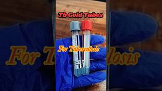 Tb Gold TubesTb Gold sample collection tubesTuberculosis test youtubeshorts shorts tranding [upl. by Wrennie594]