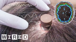 The Science Behind Elon Musk’s Neuralink Brain Chip  WIRED [upl. by Soilisav935]