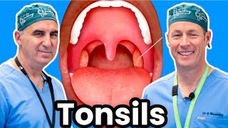 Tonsils Should You Get Yours Taken Out [upl. by Vivianna]