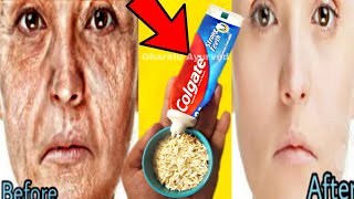 20 साल पुरानी झाइयां और झुर्रियां गायब रात में 1 चम्मच लगा लो  pigmentation remove remedy [upl. by Benkley]