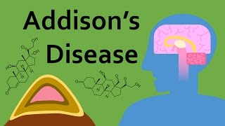 Addisons Disease and Corticosteroids Part 1 [upl. by Novi]