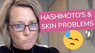 3 Common Skin Problems Associated with Hashimotos  Sara Peternell [upl. by Anaed]