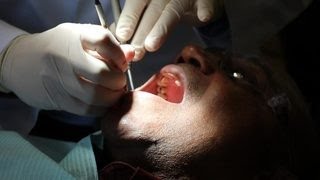 How 1 drug can regrow teeth [upl. by Ordnassela909]