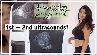 4 Weeks Pregnant  Early Ultrasound and Ectopic Pregnancy Scare [upl. by Jara301]