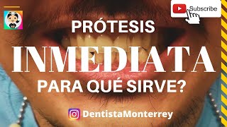 PRÓTESIS DENTAL INMEDIATA👅Que Es y para que Sirve ProtesisDental PPR [upl. by Rubia]