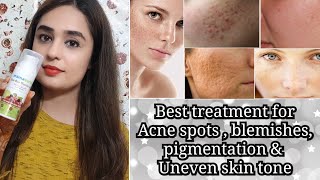 Best Face Cream for BlemishesPigmentation  Acne scars amp Uneven skin toneफाउंडेशन से पहले इसे लगाए [upl. by Imeon1]