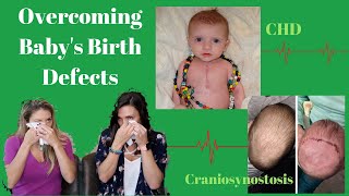 Unexpected Birth Defects How To Get You And Your Baby Through It  CHD amp Craniosynostosis [upl. by Jung]