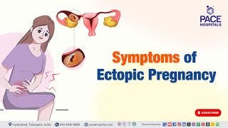 Symptom of Ectopic Pregnancy  EctopicPregnancy [upl. by Ayotahs171]