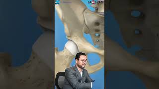 When is Hip Replacement Surgery Necessary 🏥  Dr Debashish Chanda [upl. by Enaamuj50]