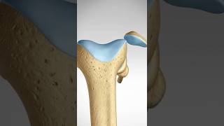 What happens when you dislocate your Knee Cap MPFL Tears and Reconstruction kneeanatomy [upl. by Sucramel]