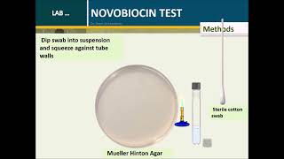 Novobiocin test Coagulase Negative Staphylococci S epidermidis and S saprophyticusversion 02 [upl. by Bette-Ann198]