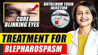 Blepharospasm and Botulinum Toxin Injections  Botulinum Toxin Mechanism of Action  Dr Rwituja [upl. by Lorna821]