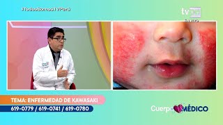 Cuerpo Médico Enfermedad de Kawasaki 19092022  TVPerú [upl. by Joellen568]