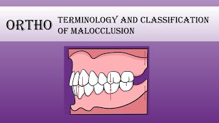 Ortho  Terminology and classification of malocclusion Part 1 [upl. by Maloney]