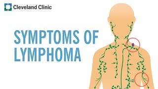 Warning Signs of Lymphoma [upl. by Ossie]