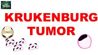 METASTATIC OVARIAN TUMORS KRUKENBERG TUMOR  Ovarian Tumor Series Part 7 [upl. by Namia]