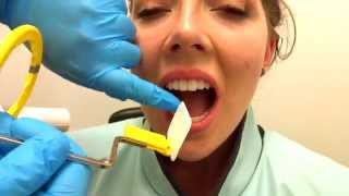 How to Take Periapical Radiographs [upl. by Shoshanna]