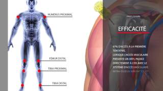 The Arrow® EZIO® Intraosseous Vascular Access System [upl. by Nilauqcaj27]