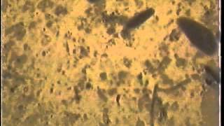 Rumen Video small protozoawmv [upl. by Salomone454]