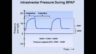 NonInvasive Positive Pressure Ventilation Mechanical Ventilation  Lecture 6 [upl. by Sone]