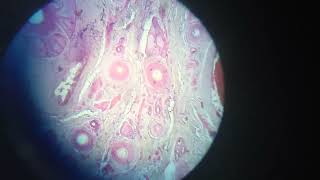 ⚫Thin skin histology slide⚫  with hair follicle  sebaceous gland sweat glands [upl. by Egas675]