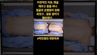 파킨슨병 약을 장기 복용 할때 나타나는 부작용을 보면서 자연적인 치료를 원하셨다 척추교정 파킨슨병공황장애 우울증 치매 [upl. by Beach854]