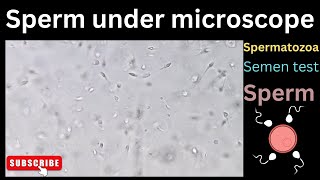 Sperm under microscope  Semen test  Spermatozoa  medicallabtechnologysajal6903 [upl. by Attalie328]