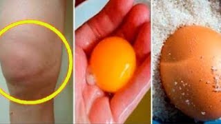 Eliminate knee inflammation and pain with egg and salt home remedy [upl. by Enneira]