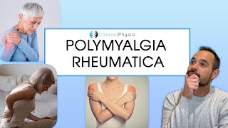 Polymyalgia Rheumatica  Signs and Symptoms of PMR [upl. by Jeffers]