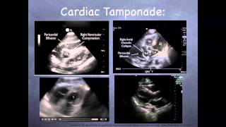 Tutorial Basic echocardiography [upl. by Chloe]