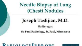 Your Radiologist Explains Needle Biopsy of Lung Chest Nodules [upl. by Olraced368]