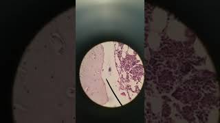 Bone decalcified histology [upl. by Llesram]