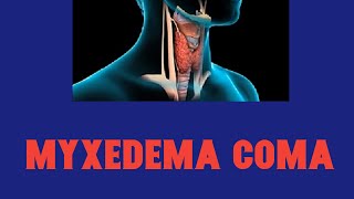 Myxedema coma  Hypothyroidism [upl. by Benildis]