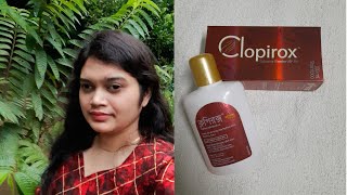 Clopirox Shampoo review jonakisexclusive2070 [upl. by Nabetse]