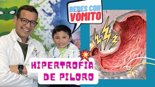 Ayuda mi bebé vomita es reflujo o tiene ESTENOSIS HIPERTROFICA DE PILORO Como saber [upl. by Sharp]