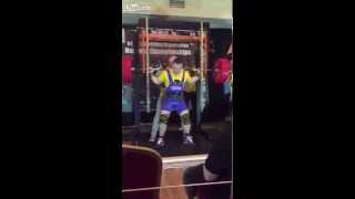 Brutal Weightlifting Accident Squatter Rips His Quads Right From The Bone [upl. by Bush454]