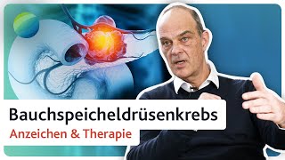 Bauchspeicheldrüsenkrebs Warnzeichen frühzeitig erkennen  Diagnose amp Therapie [upl. by Husha]