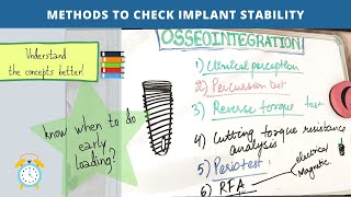 osseointegration of dental implants  final part [upl. by Meng628]