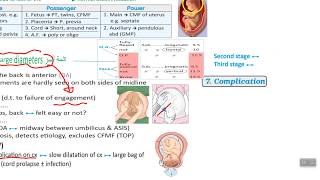 Malpresentations scheme [upl. by Nomed]