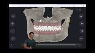 Online viewer for your setups  inhouse aligners [upl. by Eillas309]