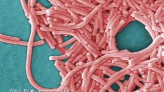 Legionnaires Disease What You Need to Know [upl. by Ariem]