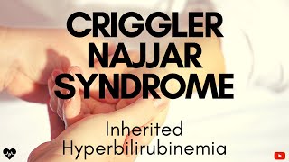 Criggler Najjar SyndromeInherited HyperbilirubinemiaThe Beat yt [upl. by Lertnom]