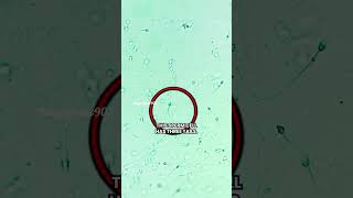 What does a semen microscope mainly look like feedshorts viralshort facts fact shorts yt [upl. by Ennywg]