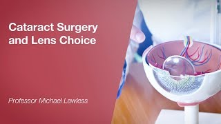 Cataract Surgery and Lens Choice [upl. by Enyalaj]