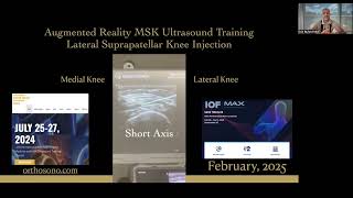 MSK Ultrasound Injections Augmented Reality Lateral Knee Injection [upl. by Elleynod]